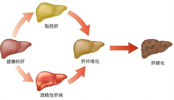 揭秘PODEEY晚安护肝|为什么黑牛肝菌+PQQ+D核糖的护肝配方备受关注